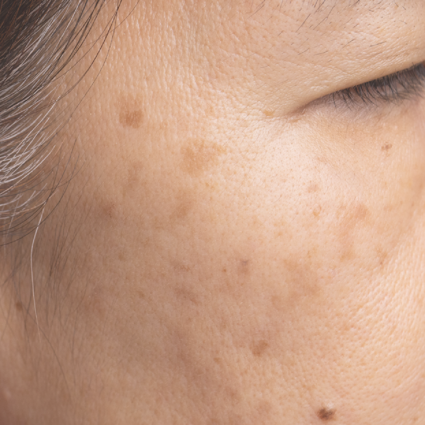 Dark Spots